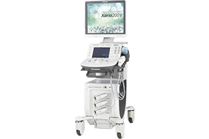 超音波検査（エコー）